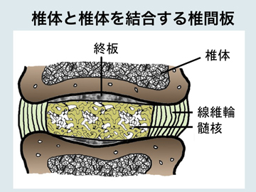 椎間板.jpg