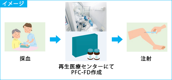 PFC-FD療法のイメージ