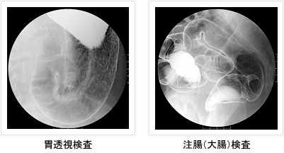 胃透視検査 / 注腸（大腸）検査